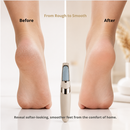 Heelisse SmoothStep